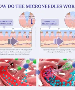 Honxi® NIDDK-Tirzepatide Nano Microneedle Patch