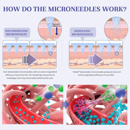 Honxi® NIDDK-Tirzepatide Nano Microneedle Patch