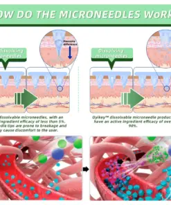 Honxi™ SMGT-GLP-1 Nano Microneedle Patch