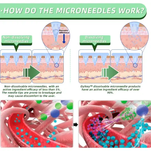 Honxi™ SMGT-GLP-1 Nano Microneedle Patch