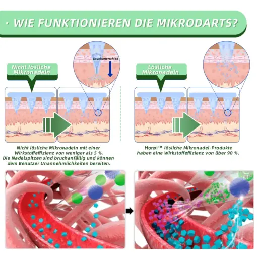 Honxi™ SMGT-GLP-1 Nano-Mikronadel-Pflaster